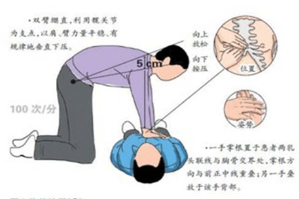 安全拓展培訓(xùn)-生命急救